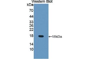 Western blot analysis of the recombinant protein. (DUSP5 anticorps  (AA 1-135))