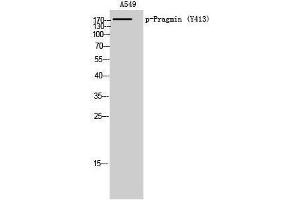 Western Blotting (WB) image for anti-Tyrosine-Protein Kinase SgK223 (SGK223) (pTyr413) antibody (ABIN3172968) (PRAGMIN anticorps  (pTyr413))