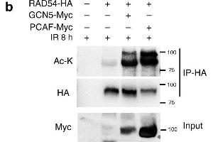 RAD54 acetylation is important for BRD9 recognition and HR activity.
