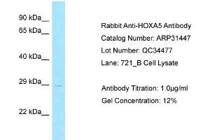 WB Suggested Anti-HOXA5 Antibody Titration:  0. (HOXA5 anticorps  (Middle Region))