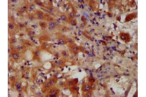 IHC image of ABIN7163270 diluted at 1:400 and staining in paraffin-embedded human liver tissue performed on a Leica BondTM system. (PACS2 anticorps  (AA 268-465))