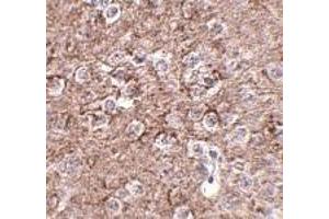 Immunohistochemistry of IL-16 in mouse brain tissue with IL-16 antibody at 2.