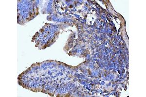 IHC analysis of GLUL using anti-GLUL antibody (ABIN7602403). (GLUL anticorps  (AA 74-373))