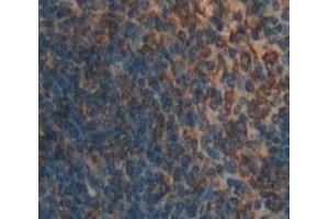Used in DAB staining on fromalin fixed paraffin- embedded Kidney tissue (DC-SIGN/CD209 anticorps  (AA 115-238))