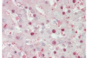 Immunohistochemistry with Liver cell lysate tissue (ATOH1 anticorps  (Middle Region))