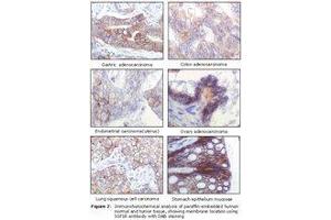 Image no. 1 for anti-Insulin-Like Growth Factor 1 Receptor (IGF1R) antibody (ABIN232138) (IGF1R anticorps)