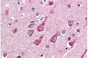 Human Brain, Cortex (formalin-fixed, paraffin-embedded) stained with OGT antibody ABIN337257 at 5 ug/ml followed by biotinylated anti-goat IgG secondary antibody ABIN481715, alkaline phosphatase-streptavidin and chromogen. (OGT anticorps  (AA 543-555))