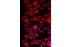 Immunofluorescence analysis of HeLa cells using BLMH antibody (ABIN6127522, ABIN6137574, ABIN6137575 and ABIN6222197). (BLMH anticorps  (AA 1-300))