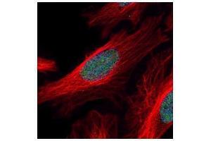 ICC/IF Image Confocal immunofluorescence analysis (Olympus FV10i) of paraformaldehyde-fixed HeLa, using ZNF38, antibody (Green) at 1:500 dilution.