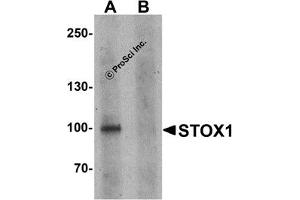 Western Blotting (WB) image for anti-Storkhead Box 1 (STOX1) (C-Term) antibody (ABIN1030709) (STOX1 anticorps  (C-Term))