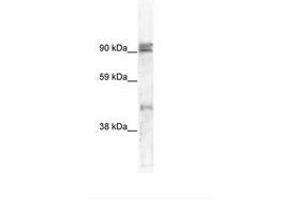 Image no. 1 for anti-Zinc Finger Protein 227 (ZNF227) (AA 118-167) antibody (ABIN6736006) (ZNF227 anticorps  (AA 118-167))