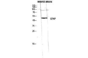 Western Blotting (WB) image for anti-Glial Fibrillary Acidic Protein (GFAP) (Ser423) antibody (ABIN3184781) (GFAP anticorps  (Ser423))