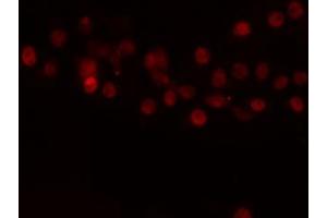 ABIN6274220 staining COLO205 cells by IF/ICC.