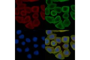 ABIN6257034 and ABIN6275778 staining Hela cells(30 min of UV treatment) by IF/ICC. (KRT37,38 (C-Term) anticorps)