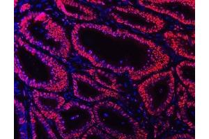 IF analysis of Ku70 using anti-Ku70 antibody (ABIN7602790).