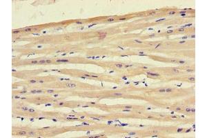 Immunohistochemistry of paraffin-embedded human heart tissue using ABIN7151354 at dilution of 1:100 (ART5 anticorps  (AA 45-291))