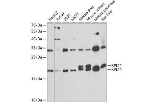 Western blot analysis of extracts of various cell lines, using RPL11 antibody (ABIN6129101, ABIN6147106, ABIN6147108 and ABIN6222040) at 1:1000 dilution.