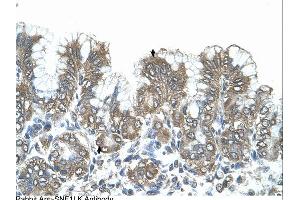Immunohistochemistry (IHC) image for anti-Salt-Inducible Kinase 1 (SIK1) (N-Term) antibody (ABIN2782413)