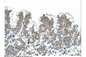 Immunohistochemistry (IHC) image for anti-Salt-Inducible Kinase 1 (SIK1) (N-Term) antibody (ABIN2782413) (SIK1 anticorps  (N-Term))