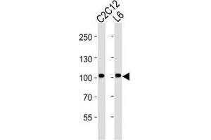 Western blot analysis of lysate from C2C12, L6 cell line (left to right) using Musk antibody at 1:2000 for each lane. (MUSK anticorps)
