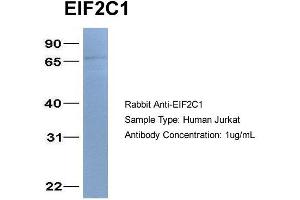 Host: Rabbit Target Name: EIF2C1 Sample Type: Jurkat Antibody Dilution: 1. (AGO1 anticorps  (N-Term))