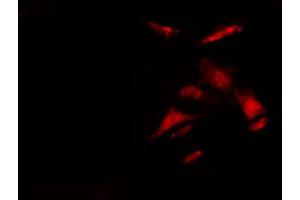 ABIN6272439 staining 293 by IF/ICC.