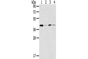 Gel: 8 % SDS-PAGE,Lysate: 40 μg,Lane 1-4: 293T cells, K562 cells, Lovo cells, Human bladder carcinoma tissue,Primary antibody: ABIN7191340(MAGEA11 Antibody) at dilution 1/200 dilution,Secondary antibody: Goat anti rabbit IgG at 1/8000 dilution,Exposure time: 30 seconds (MAGEA11 anticorps)