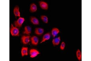 Immunofluorescent analysis of A549 cells using ABIN7152690 at dilution of 1:100 and Cy3-congugated Goat Anti-Rabbit IgG