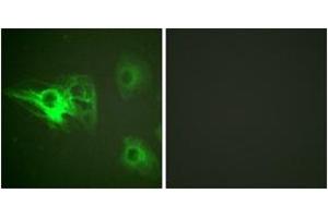 Immunofluorescence analysis of HeLa cells, using Keratin 8 (Phospho-Ser432) Antibody.