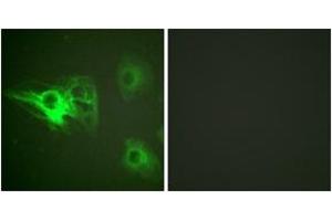 Immunofluorescence analysis of HeLa cells, using Keratin 8 (Phospho-Ser432) Antibody. (KRT8 anticorps  (pSer432))