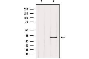 Western blot analysis of extracts from Mouse lung, using TRIO Antibody. (TRIO anticorps  (Internal Region))
