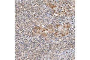 IHC analysis of SLC20A1 using anti-SLC20A1 antibody (ABIN7602463).