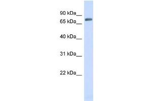 WB Suggested Anti-TRIM41 Antibody Titration:  0. (TRIM41 anticorps  (N-Term))