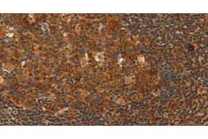 Immunohistochemistry of paraffin-embedded Human tonsil using HDAC8 Polyclonal Antibody at dilution of 1:40