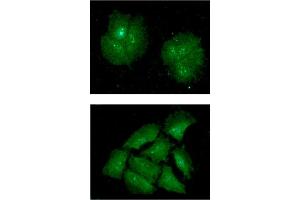 anti-IMP3, U3 Small Nucleolar Ribonucleoprotein (IMP3) (AA 1-184) antibody