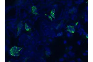 Image no. 1 for anti-Keratin 7 (KRT7) antibody (ABIN335336) (Cytokeratin 7 anticorps)