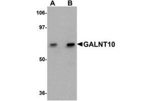 Western Blotting (WB) image for anti-UDP-N-Acetyl-alpha-D-Galactosamine:polypeptide N-Acetylgalactosaminyltransferase 10 (GalNAc-T10) (GALNT10) (C-Term) antibody (ABIN1030404) (GALNT10 anticorps  (C-Term))