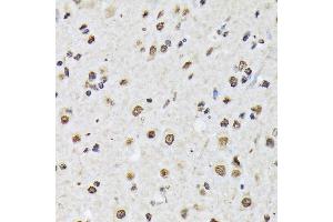 Immunohistochemistry of paraffin-embedded mouse spinal cord using Matrin 3 Rabbit mAb (ABIN7268414) at dilution of 1:100 (40x lens).