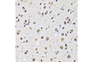 Immunohistochemistry of paraffin-embedded mouse spinal cord using Matrin 3 Rabbit mAb (ABIN7268414) at dilution of 1:100 (40x lens). (MATR3 anticorps)