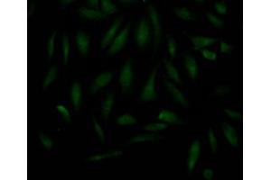 anti-MAD2 Mitotic Arrest Deficient-Like 2 (MAD2L2) antibody