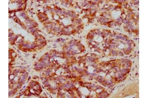 IHC image of ABIN7127637 diluted at 1:71.