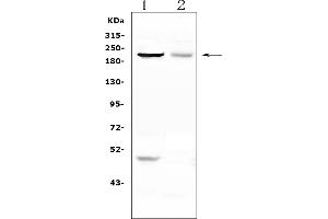 Western blot analysis of KIF20B using anti-KIF20B antibody (ABIN6719429).