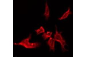 ABIN6276151 staining Hela by IF/ICC. (OR4C15 anticorps  (C-Term))