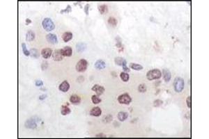 Immunohistochemistry (IHC) image for anti-Mitogen-Activated Protein Kinase-Activated Protein Kinase 5 (MAPKAPK5) (truncated) antibody (ABIN2464093)