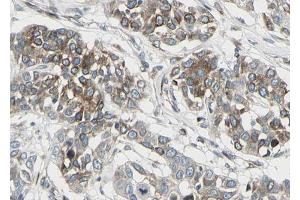 ABIN6268745 at 1/100 staining human lung tissue sections by IHC-P.