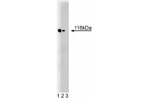 Western blot analysis of TAO1 on a rat cerebrum lysate. (TAO Kinase 2 anticorps  (AA 352-550))