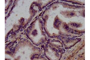 IHC image of ABIN7175671 diluted at 1:200 and staining in paraffin-embedded human prostate tissue performed on a Leica BondTM system.