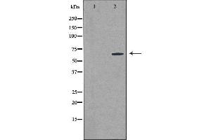 Western blot analysis of extracts from MCF-7 cells using CSTF2T antibody. (CSTF2T anticorps  (N-Term))