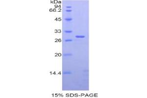 SDS-PAGE analysis of Rat ADAM6 Protein. (ADAM6A Protéine)