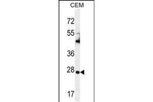 Western blot analysis in CEM cell line lysates (35ug/lane). (TIMP1 anticorps  (C-Term))